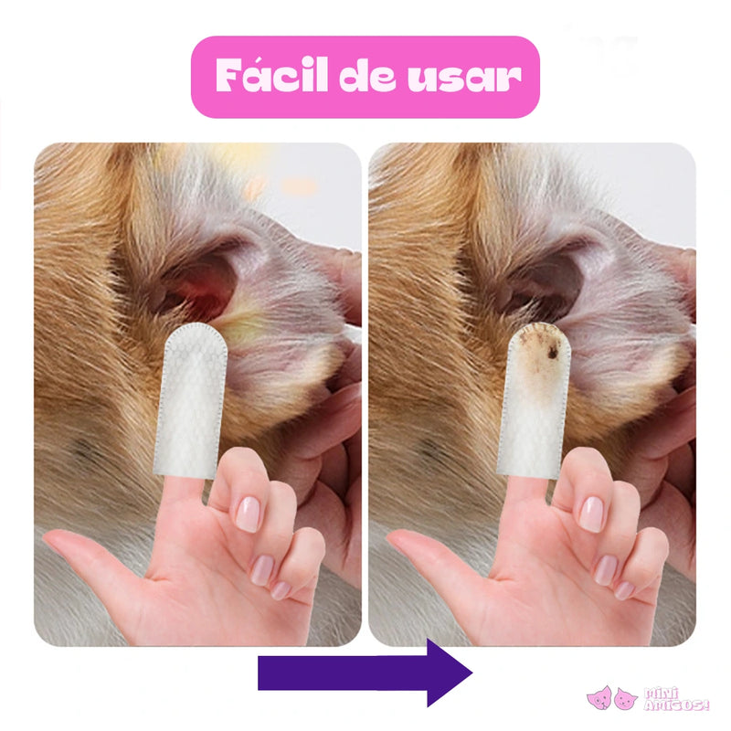 Limpador de orelhas